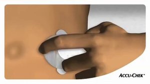 Инструкция по установке инфузионного набора Акку-чек ТендерЛинк