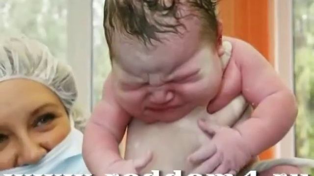 Необычные роды