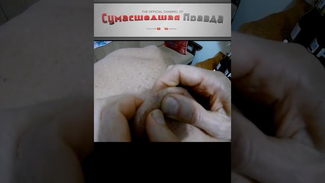 Топ 5 опасных насекомых. Овод.