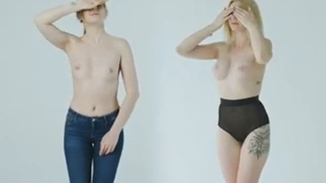 Результат маммопластики. Пластический хирург Цой Юрий