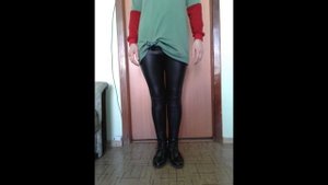 Варусная деформация ног