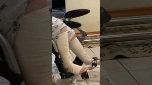 Осложнения после эндопротезирования миф или реальность?