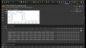 Нейронные сети - пример нейронной сети для классификации аритмии по ЭЭГ