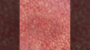 Рука под микроскопом