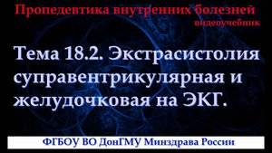 Тема 18.2. Экстрасистолия суправентрикулярная и желудочковая на ЭКГ.