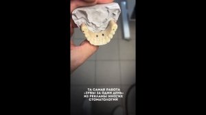 Зубы , которые меняют жизнь ) на видео - зубы, с опорой на 4 имплантата. Делают их когда нет зубов)