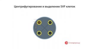 SVF-терапия коленного сустава