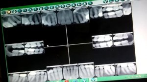 Dental X-ray System Universal platforms using AT&T API.