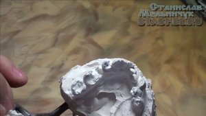 Прикусные шаблоны для последующей обточки и моделировки зубов при сложных или заниженных прикусах