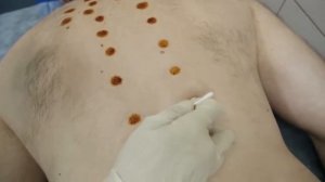 644. О методе RANC и Клинике "НЕВРОЛОГИКА".