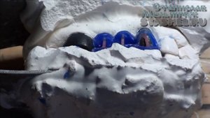 Штампованные зубные коронки. Мост с облицовкой на полуразрушенном опорном зубе.