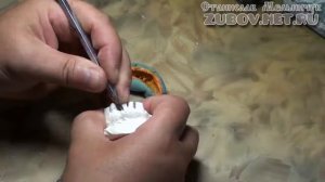 Изготовление зубных штампованных коронок. Гравировка шеек зуба