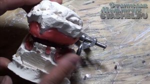 ЗУБНЫЕ ПРОТЕЗЫ. Перекрёстный прикус на съёмных зубных протезах