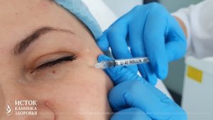 Ботокс. Лечение красоты ботулотоксинами.