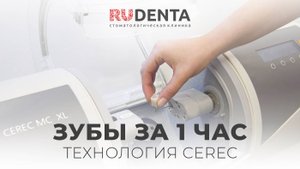 CEREC в Рудента: зубы за час
