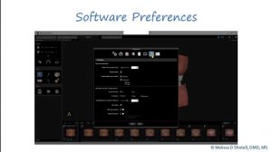 Carestream Model+ Growing A Practice with In-Office Clear Aligners