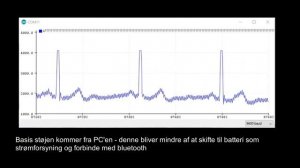ESP32 AD8232 Arduino Bluetooth ECG (simple)