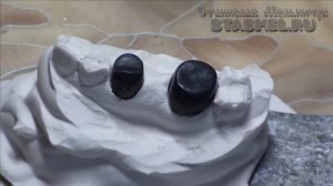 Штампованные коронки. Мост в три единицы. Обработка литка. Фиксация литка липким воском к коронкам.