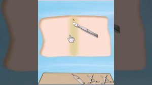 Appendix Surgery  Simulation Game Android Game