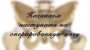 Готовимся к ходьбе. Даем нагрузку на протез. Начинаем наступать на оперированную ногу
