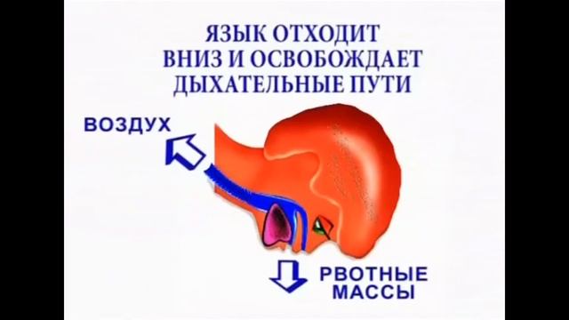 Курсы первой медицинской помощи часть 1 смотреть онлайн