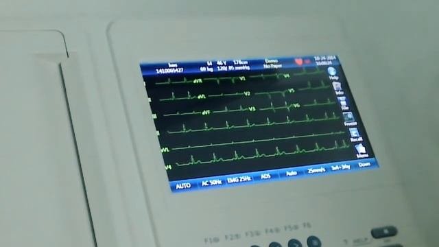 Introducing Carewell 1112M 12-channel ECG