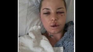 Christy Mack Photos, After Alleged War Machine Assault