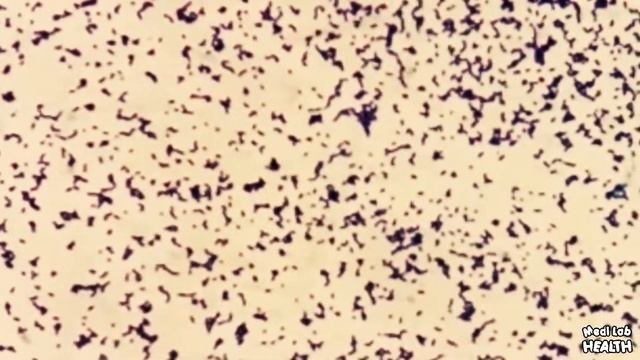 Staphylococcus Aureus Gram Stain Microscopic Observation