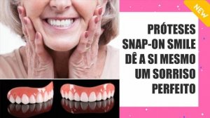 Preço das facetas por dente