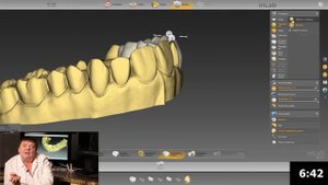 Как зубному технику быстро перейти в цифру