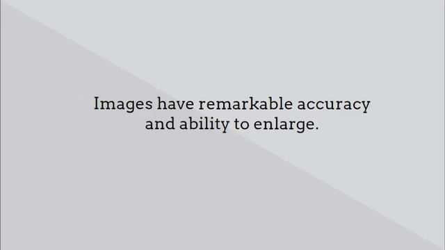 Glen Allen VA Dentist | Digital X-Rays смотреть онлайн