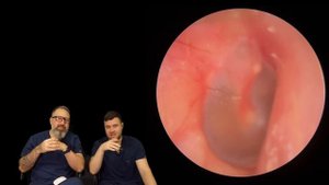 HARD EAR WAX PLUGS, KERATIN & GOLDFISH EAR WAX REMOVAL - EP936
