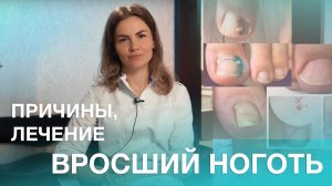 Вросший ноготь – навсегда?