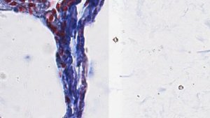 Однослойный плоский эпителий