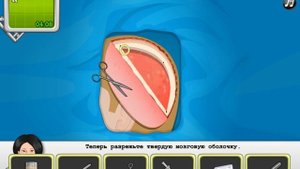Pазвлекательныe игры -Теперь хирургия эпилепсия -образовательные игры для детей