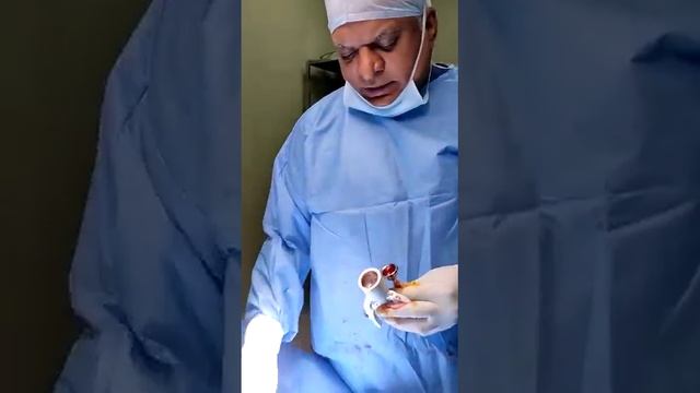 ZSR STAPLER CIRCUMCISION component parts description смотреть онлайн