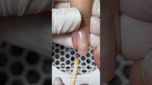 Коррекция ногтей.