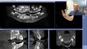 Galileos Implant Viewer von Sirona - Installationsanleitung - Bedienungsanleitung