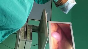 karl storz|Laparoscopy Unit|working Demonstration|karlstorz Co2 insufflator, Karl storz camera