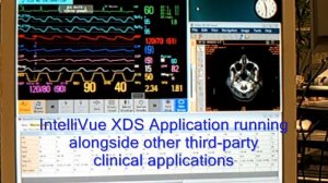 XDS with CIS and PACS.wmv