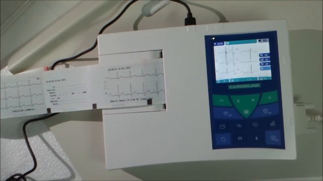 Cardioline Ar600view