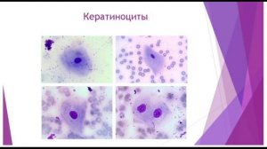 Мазок крови. Приготовление. Окрашивание. Исследование