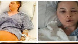 War Machine's Ex, Christy Mack, Releases Statement and Graphic Photos of Alleged Assault