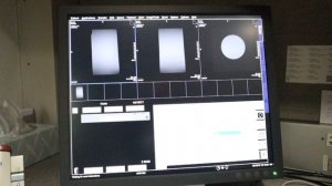 Siemens Syngo MRI Adjust Volume tutorial.