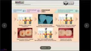 02. 2019 02 05 Сидоров Владимир Иванович Протезирование на имплантах Ч1 1