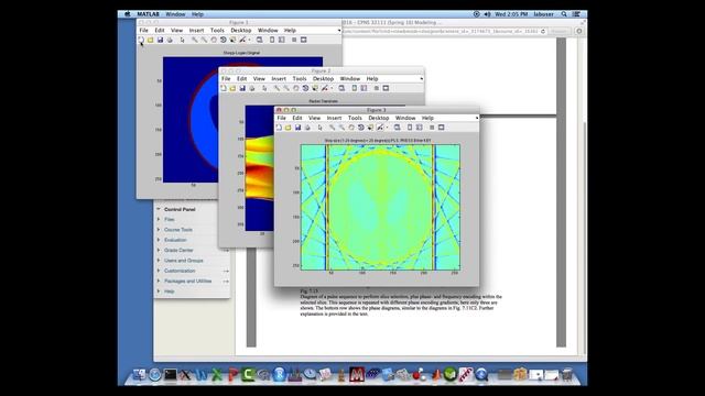 Lecture 5C: 2D-Fourier Transform & applications to medical imaging(CT,MRI), Dr. Wim van Drongelen смотреть онлайн