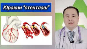 ЮРАККА СТЕНТ ҚЎЙИШ ҲАҚИДА БАФУРЖА МАЪЛУМОТ, САВОЛЛАРГА ЖАВОБЛАР ДОКТОР ИСЧАНОВ