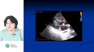 Легочная гипертензия. Профессор Рыбакова М.К. 2017г