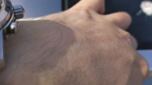 Протекает панорамная крыша. Peugeot 308 T9. Как решить проблему?