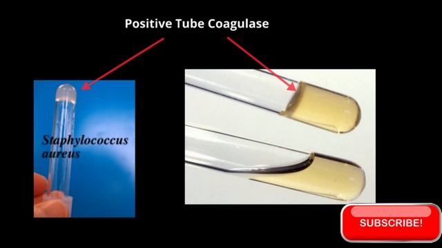 Methicillin Resistant Staphylococcus aureus ( MRSA ) смотреть онлайн
